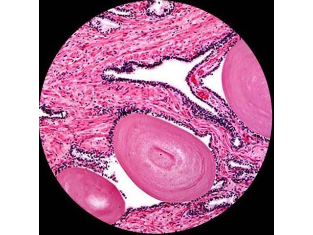 Binocular Compound Microscope T45373